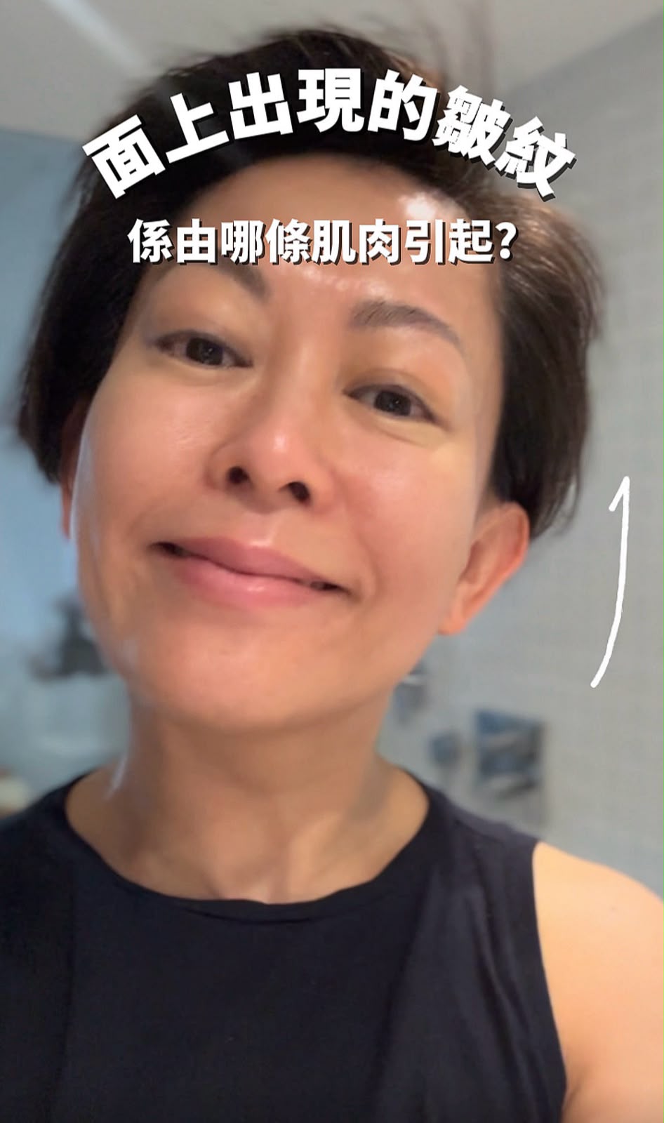 Winnie：面上出現的皺紋，係由哪條肌肉引起？